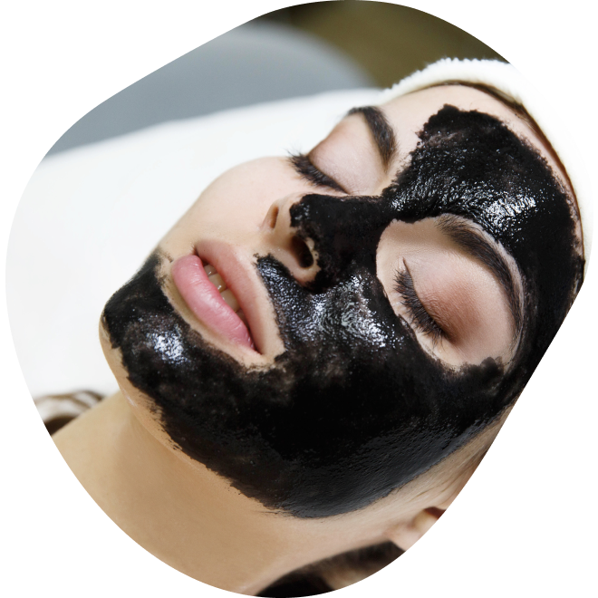 Carbon Peel