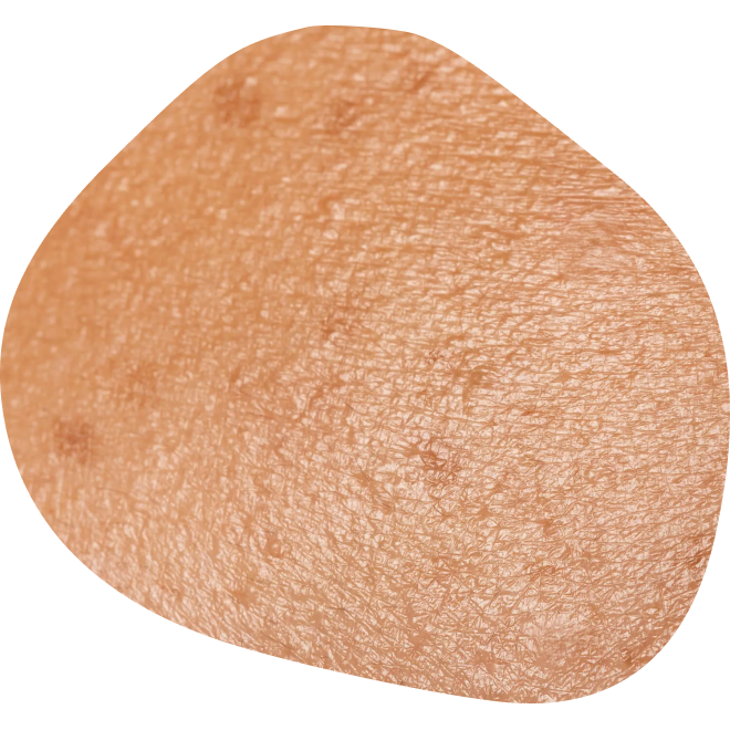 Pigmentációs rendellenességek